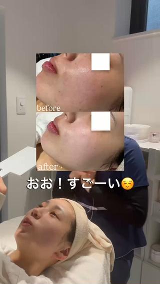 肌質改善/ mashikoのエステ・リラクイメージ