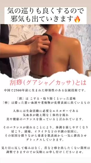 #カッサ
#肩こり
#首
#CBD
#毒抜き