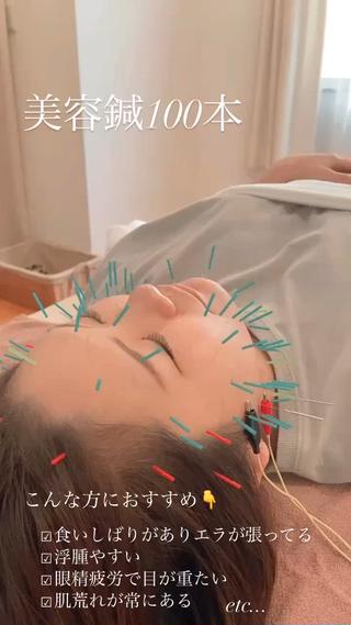 大人気100本美容鍼
 