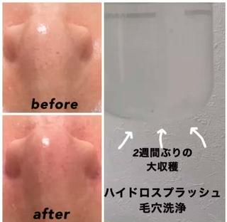 ネイル・エステサロン UILANIのエステ・リラクイメージ