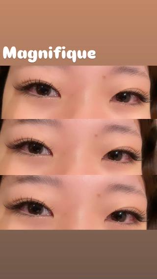 フラットラッシュ