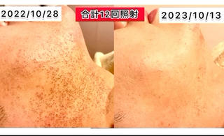 脱毛&リラク FIS福岡薬院店のエステ・リラクイメージ