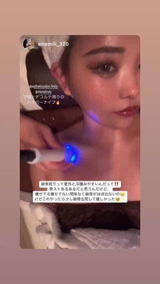 人気インフルエンサーのアメミちゃんもお気に入りのハイパーナイフフェイシャルデコルテ付き
フェイスラインや鎖骨がスッキリ見えて小顔にになります