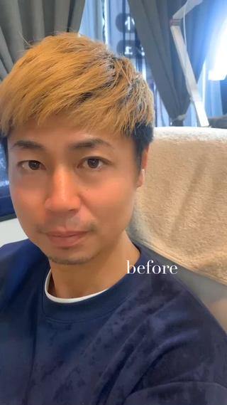 毛抜きで抜きすぎてしまった眉毛もパーマとWAXでここまで綺麗になります!
ストレートアーチ