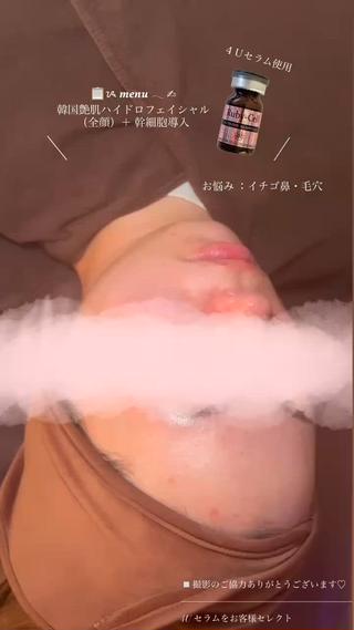 シュシュ／ hayasaのその他イメージ