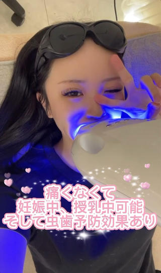 ホワイトニング
1回でめーーーちゃ白くなります
初回¥3,300-