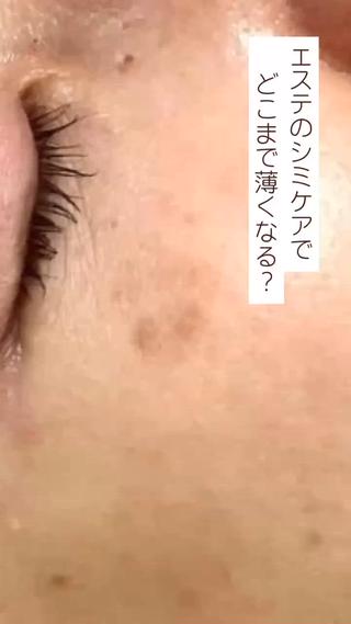 素肌をキレイに ラウレア🌼Hayaのエステ・リラクイメージ
