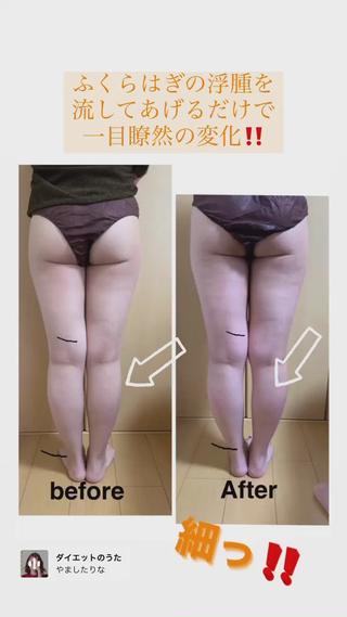 ダイエット目的だけではなく
浮腫や冷え性、血流改善にも効果があります

ダイエットではなく
血流改善のお客様には
バキュームはせずキャビテーションと
温める機能で60分施術いたします
お声がけ下さいませ 