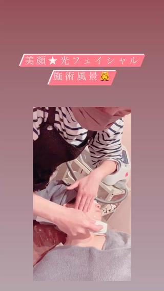 美顔★光フェイシャル照射 