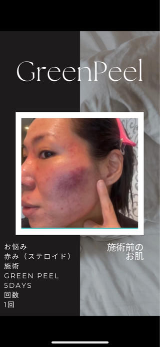 肌トラブルお任せください