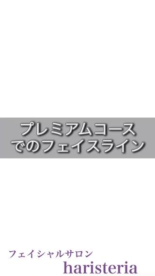 フェイスライン比較写真です。
たるみがリフトアップされてスッキリ・シャープな顔になっています