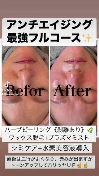 韓国美肌管理サロン ペルボヌールのエステ・リラクイメージ