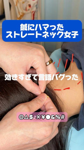 首肩こりがつらい方へ
スマホ首・眼精疲労に
食いしばり・顎まわりに