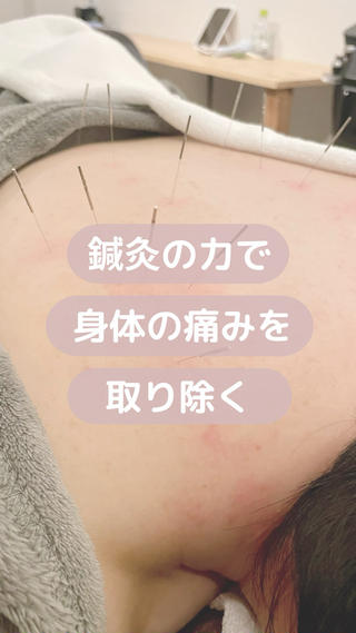 美容鍼/鍼灸 ここみ鍼灸院のエステ・リラクイメージ