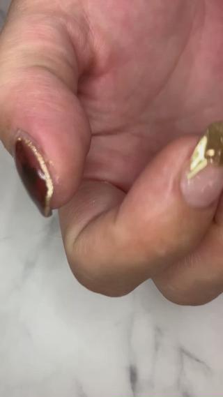 Nail 