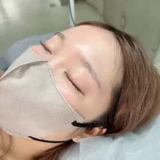 リフエク