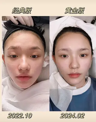 ネイル 愛維美水光専門店 川崎彩鳳のエステ・リラクイメージ