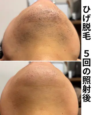 脱毛サロン FIS武蔵小杉店のエステ・リラクイメージ