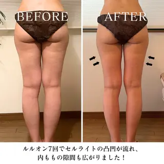 【目黒】本格痩身✴︎ 最新型よもぎ蒸しのエステ・リラクイメージ