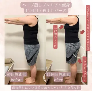 ハーブ蒸し小顔矯正 サロンLinoのエステ・リラクイメージ