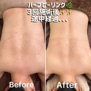舘野 はるかのエステ・リラクイメージ