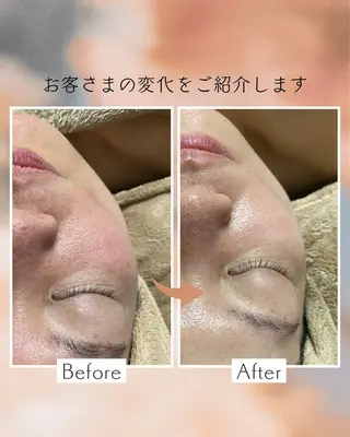 リラクゼーション necorobiのエステ・リラクイメージ
