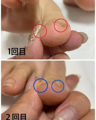 ネイル Nail 331のネイルデザイン