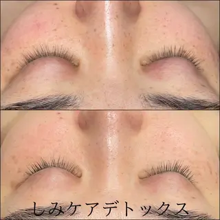 LiZA エステティックサロンのエステ・リラクイメージ