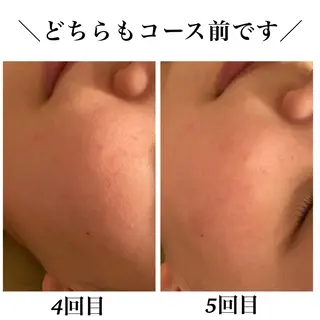 Bellesthe (ベルエステ)のエステ・リラクイメージ
