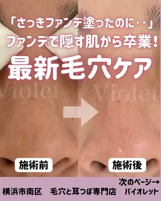 毛穴と耳つぼ専門店 バイオレット　りののその他イメージ
