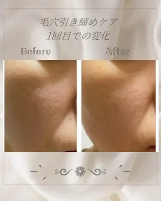 エステティックサロン ハウオリのエステ・リラクイメージ