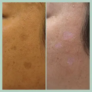 eyelash  Recona のマツエク・マツパデザイン