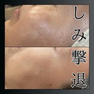 LiZA エステティックサロンのエステ・リラクイメージ