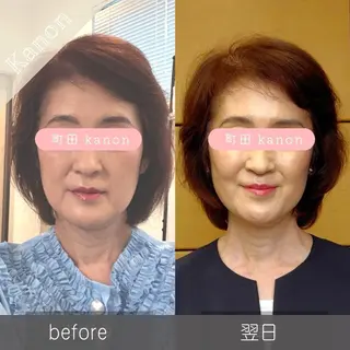 小顔矯正サロン町田 逸見智美のエステ・リラクイメージ