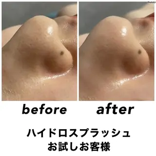 ネイル・エステサロン UILANIのエステ・リラクイメージ