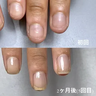 ネイル Aim* 深爪自爪育成専門店のネイルデザイン
