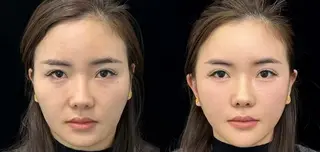 ネイル 愛維美水光専門店 川崎彩鳳のエステ・リラクイメージ