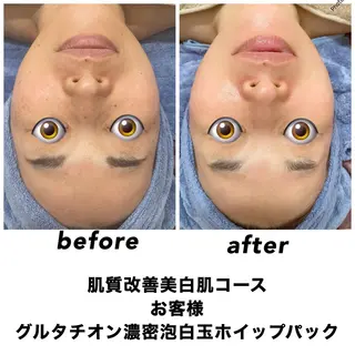 ネイル・エステサロン UILANIのエステ・リラクイメージ