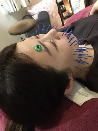 美容鍼灸女性専用 りんご鍼灸治療院のエステ・リラクイメージ