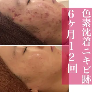 ミディアム カラー パーマ ヘアアレンジ メンズ キッズ ネイル マツエク・マツパ ニキビ・肌質改善専門 ♡人生が変わるサロンのエステ・リラクイメージ