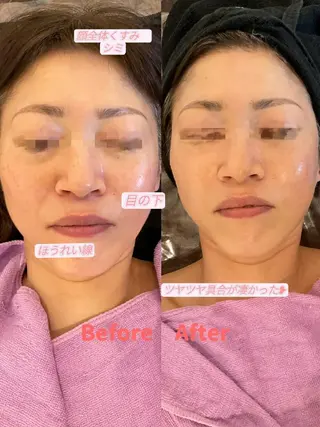 🅖🅤🅩🅔🅛 salonのエステ・リラクイメージ