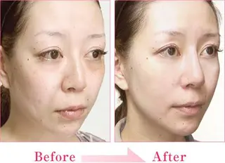 Beauty SalonMireiのエステ・リラクイメージ