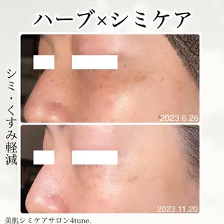 美肌シミケアサロン 4tune.RUMIのその他イメージ