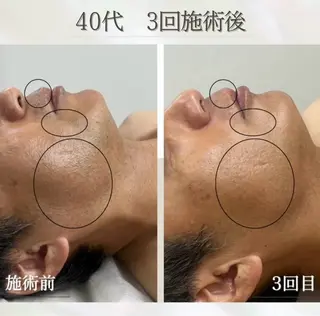 LED脱毛サロン 💐ayaのエステ・リラクイメージ