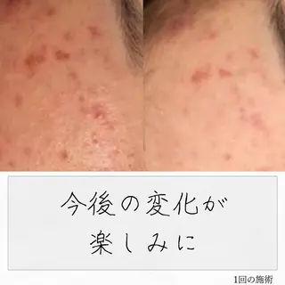 ニキビ経験者が施術 する専門サロン🌻のエステ・リラクイメージ