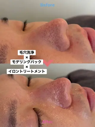 メンズ 韓国肌管理 Mikiのエステ・リラクイメージ