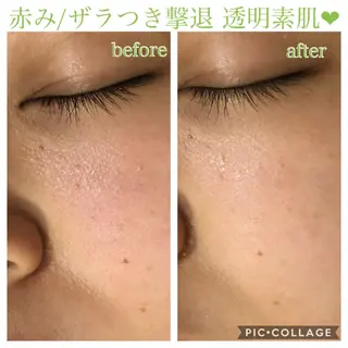 ショート カラー パーマ ヘアアレンジ キッズ ネイル マツエク・マツパ EnsorClair 代表 野口真央のエステ・リラクイメージ