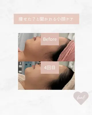 小顔/毛穴/ニキビ salon bealのエステ・リラクイメージ