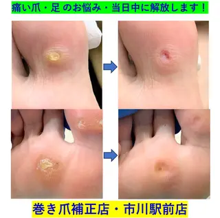 大木 祐作のネイルデザイン
