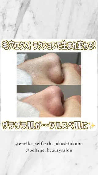 夕希 毛穴と脱毛特化サロンのエステ・リラクイメージ